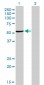 MAK Antibody (monoclonal) (M02)