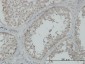 MAP3K4 Antibody (monoclonal) (M02)