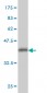 MAP3K4 Antibody (monoclonal) (M08)