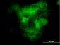 MAP3K5 Antibody (monoclonal) (M03)