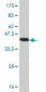 MAP3K5 Antibody (monoclonal) (M03)