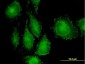 MAP3K7IP1 Antibody (monoclonal) (M03)