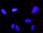 MAPK1 Antibody (monoclonal) (M01)