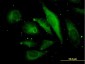 MAPRE2 Antibody (monoclonal) (M03)