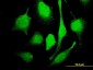 MARCH7 Antibody (monoclonal) (M01)