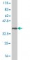 MARCH7 Antibody (monoclonal) (M01)