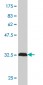 MARCKS Antibody (monoclonal) (M04)