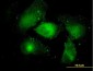 MARCKS Antibody (monoclonal) (M06)