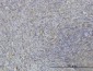 MARCKS Antibody (monoclonal) (M06)