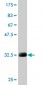 MARCKS Antibody (monoclonal) (M06)