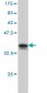 MARK2 Antibody (monoclonal) (M01)