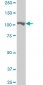 MARS Antibody (monoclonal) (M01)