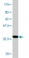 MBD1 Antibody (monoclonal) (M02)