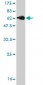 MBNL1 Antibody (monoclonal) (M01)