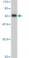 MBNL1 Antibody (monoclonal) (M02)