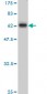 MBNL1 Antibody (monoclonal) (M02)