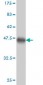 MCM3 Antibody (monoclonal) (M01)