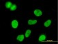 MCM3 Antibody (monoclonal) (M03)