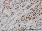 MCM7 Antibody (monoclonal) (M01)