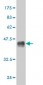 MCPH1 Antibody (monoclonal) (M07)