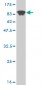 ME1 Antibody (monoclonal) (M02)