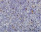 ME1 Antibody (monoclonal) (M03)