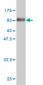 ME1 Antibody (monoclonal) (M03)