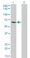 ME1 Antibody (monoclonal) (M03)