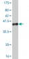 MEF2A Antibody (monoclonal) (M08)