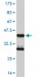 MEF2D Antibody (monoclonal) (M02)