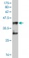 MEF2D Antibody (monoclonal) (M04)