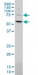 MEF2D Antibody (monoclonal) (M04)