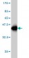 MEFV Antibody (monoclonal) (M01)