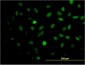 MEIS2 Antibody (monoclonal) (M03)