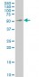 MEIS2 Antibody (monoclonal) (M03)