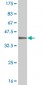 MEOX1 Antibody (monoclonal) (M02)