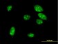 MEOX1 Antibody (monoclonal) (M07)