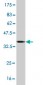MID1 Antibody (monoclonal) (M06)
