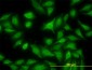 MKNK1 Antibody (monoclonal) (M06)