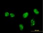 MKNK1 Antibody (monoclonal) (M14)