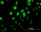 MKNK2 Antibody (monoclonal) (M04)