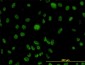 MLH1 Antibody (monoclonal) (M02)