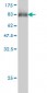 MLH1 Antibody (monoclonal) (M02)