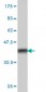 MMP26 Antibody (monoclonal) (M01)