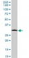 MMP26 Antibody (monoclonal) (M01)