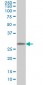 MMP26 Antibody (monoclonal) (M01)