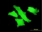 MPP1 Antibody (monoclonal) (M01)