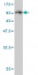 MPP1 Antibody (monoclonal) (M02)