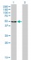 MPP1 Antibody (monoclonal) (M02)