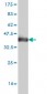 MRC1 Antibody (monoclonal) (M02)